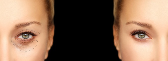 W trosce o młodość spojrzenia LIFESTYLE, Uroda - Oczy to zwierciadło duszy.To właśnie one mówią najwięcej o naszym samopoczuciu i wyrażają emocje. Niestety również jako pierwsze zdradzają nasz wiek, szczególnie kiedy skóra powiek traci sprężystość i zaczyna opadać, a wokół oczu pojawiają się bruzdy i zasinienia.